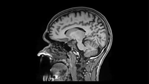 MRI image representing Head & Neck