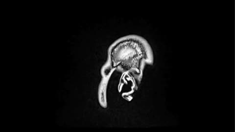 MRI image representing Musculoskeletal & Spine