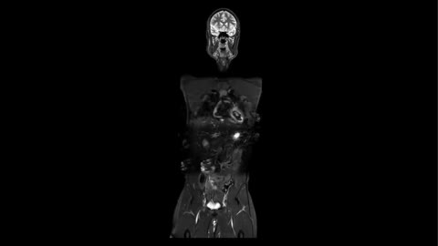 MRI image representing Abdomen & Pelvis