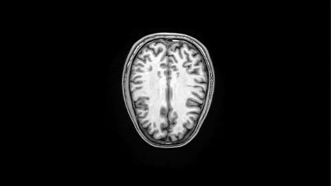 MRI image representing Whole Body Systems