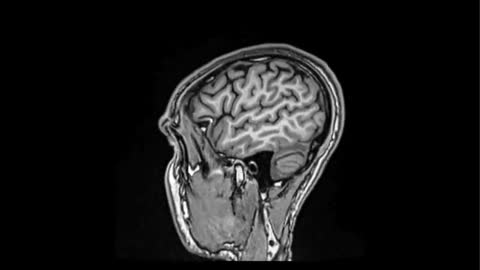 MRI image representing Chest