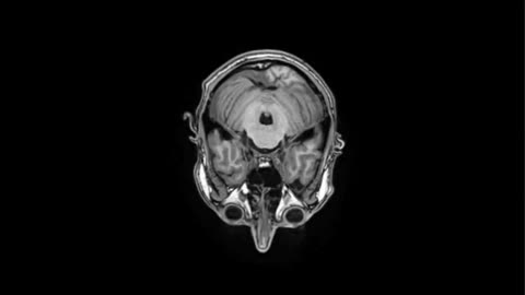 MRI image representing Blood Vessels & Circulation